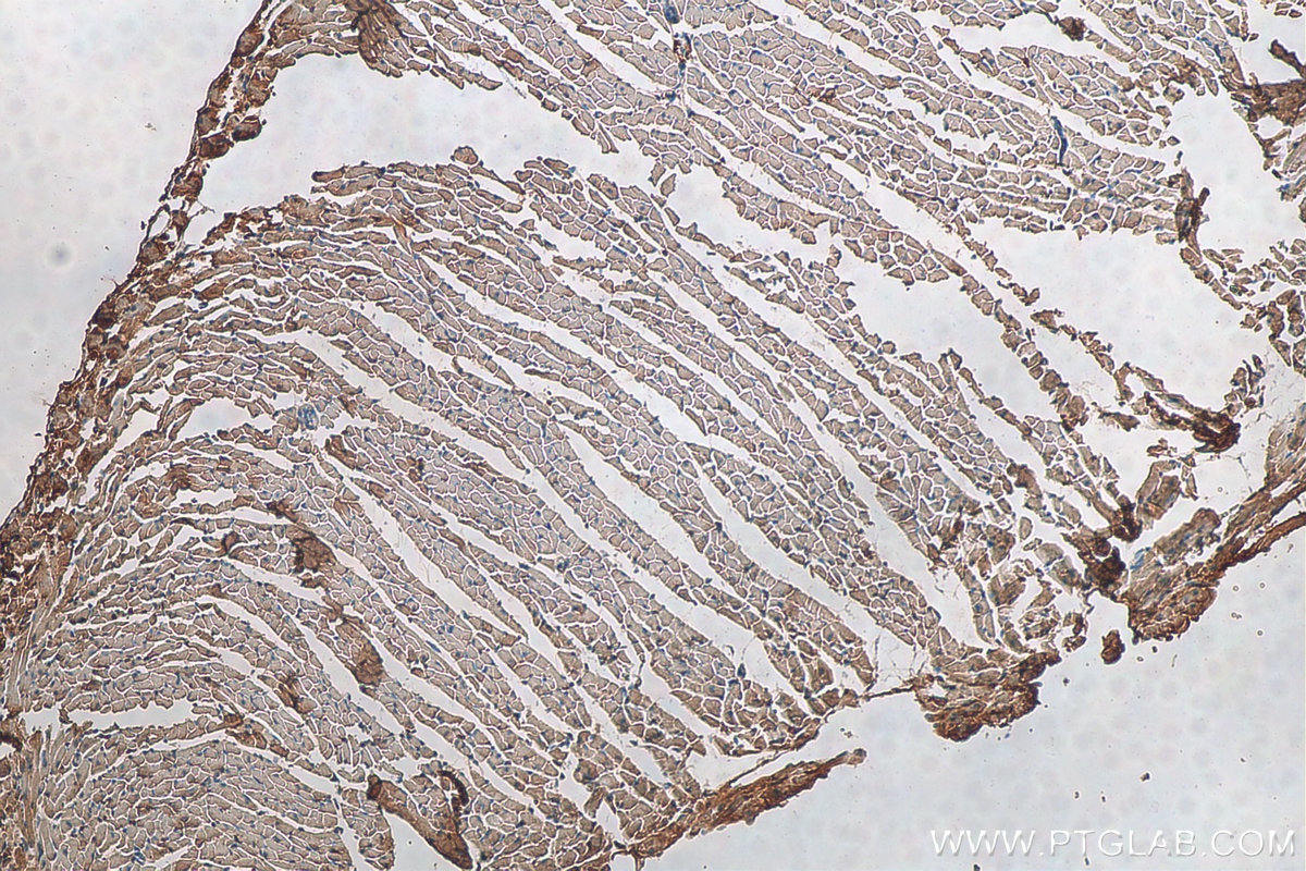 Immunohistochemistry (IHC) staining of mouse heart tissue using NTN1-Specific Polyclonal antibody (20235-1-AP)