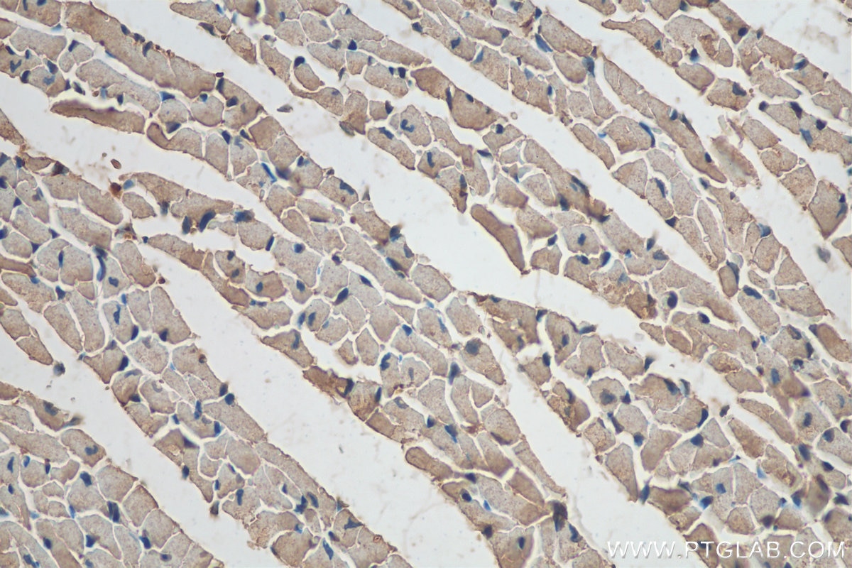 Immunohistochemistry (IHC) staining of mouse heart tissue using NTN1-Specific Polyclonal antibody (20235-1-AP)