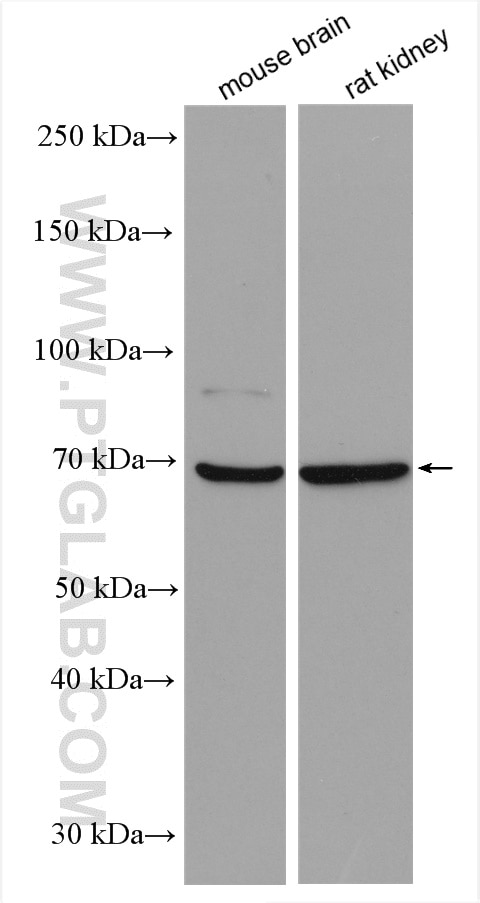 Western Blot (WB) analysis of various lysates using NTN1-Specific Polyclonal antibody (20235-1-AP)