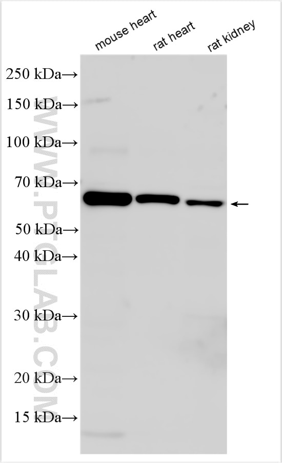 Western Blot (WB) analysis of various lysates using NTN1-Specific Polyclonal antibody (20235-1-AP)