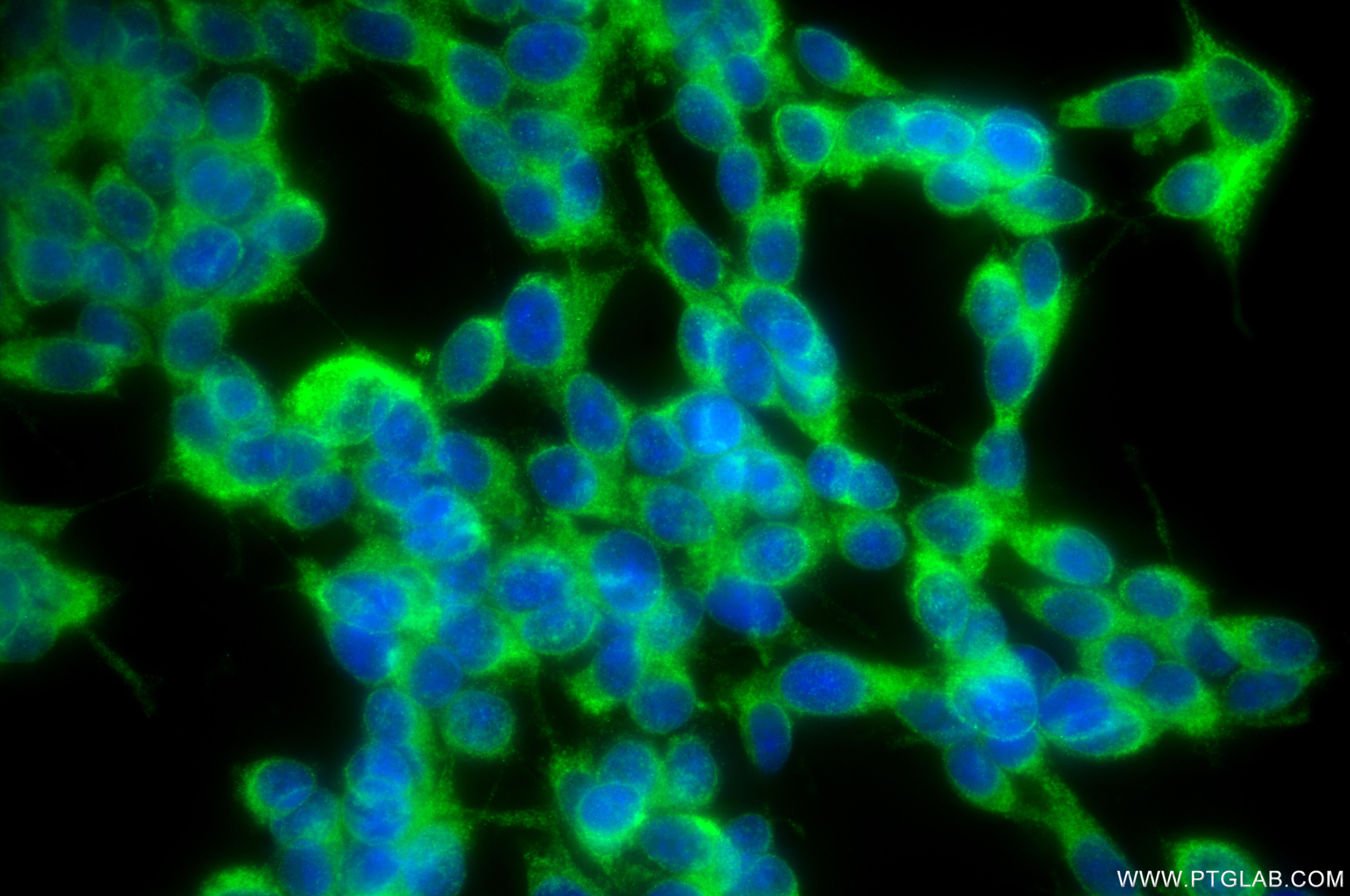 Immunofluorescence (IF) / fluorescent staining of SH-SY5Y cells using NTN1-Specific Recombinant monoclonal antibody (85375-1-RR)