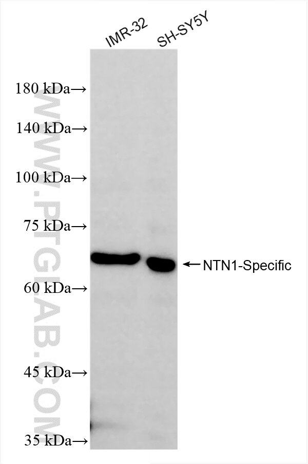 Western Blot (WB) analysis of various lysates using NTN1-Specific Recombinant antibody (85375-1-RR)