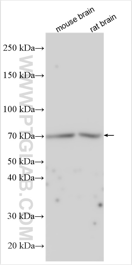 Western Blot (WB) analysis of various lysates using NTN3 Polyclonal antibody (31893-1-AP)