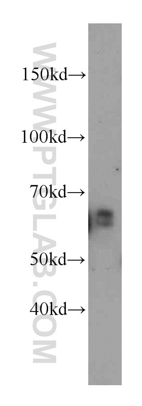 Western Blot (WB) analysis of human brain tissue using Netrin G1 Polyclonal antibody (12910-2-AP)