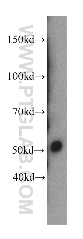 Western Blot (WB) analysis of human testis tissue using Netrin G1 Polyclonal antibody (12910-2-AP)