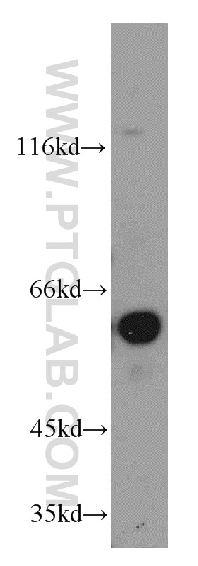 WB analysis of mouse lung using 12910-2-AP