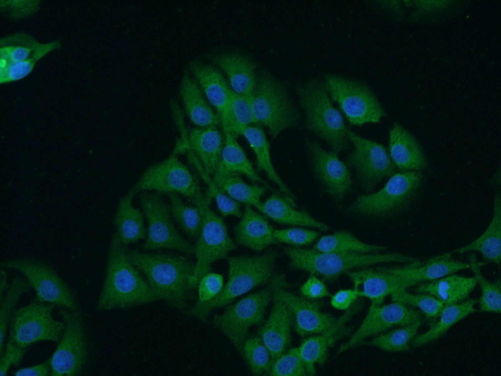 Immunofluorescence (IF) / fluorescent staining of SH-SY5Y cells using TrkB Polyclonal antibody (13129-1-AP)