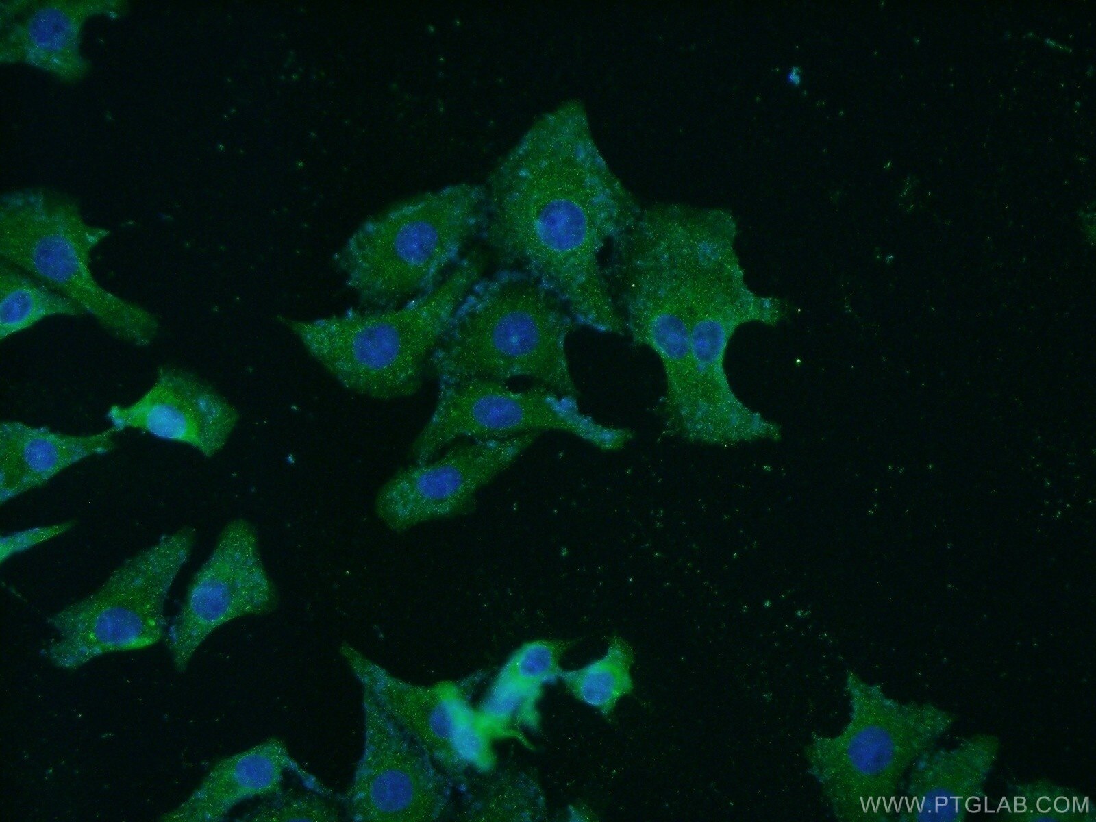 Immunofluorescence (IF) / fluorescent staining of SH-SY5Y cells using TrkB Polyclonal antibody (13129-1-AP)
