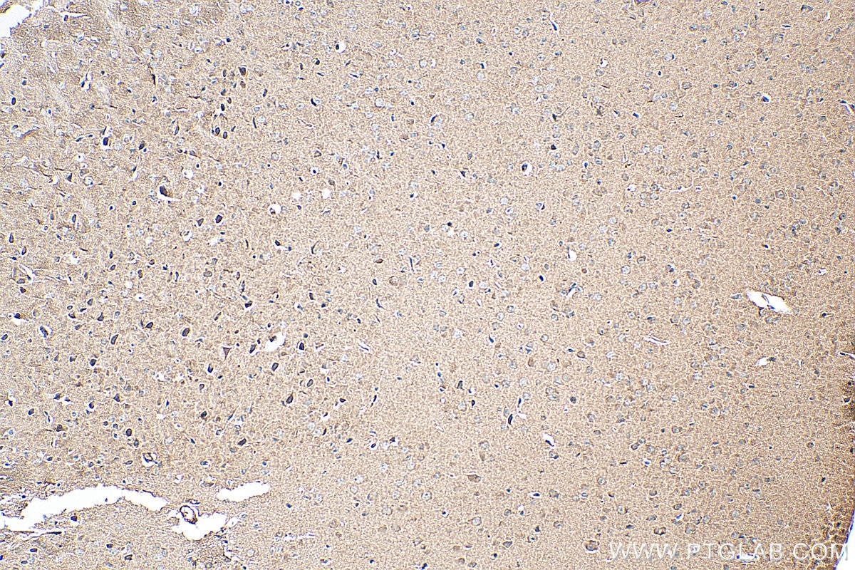 Immunohistochemistry (IHC) staining of mouse brain tissue using TrkB Polyclonal antibody (13129-1-AP)