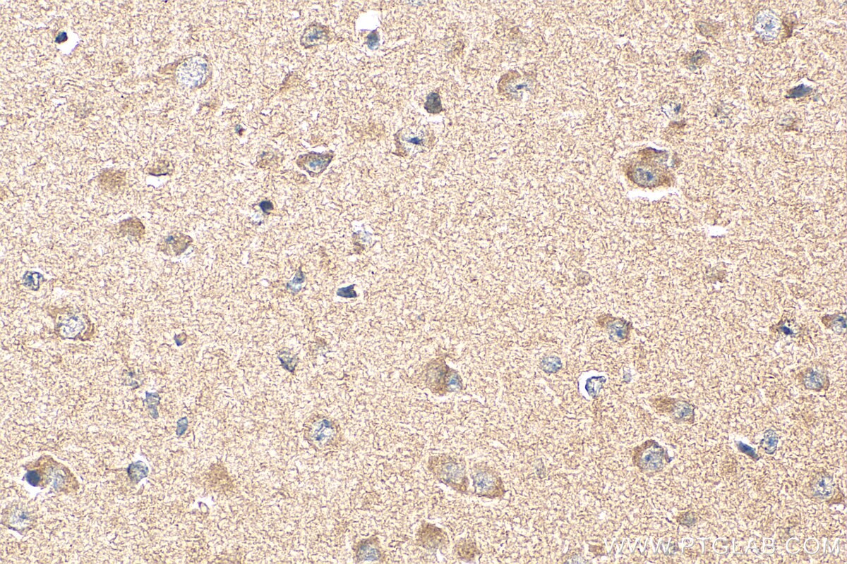 Immunohistochemistry (IHC) staining of mouse brain tissue using TrkB Polyclonal antibody (13129-1-AP)