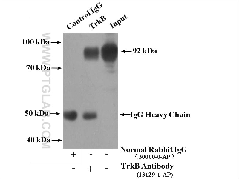 Immunoprecipitation (IP) experiment of mouse cerebellum tissue using TrkB Polyclonal antibody (13129-1-AP)