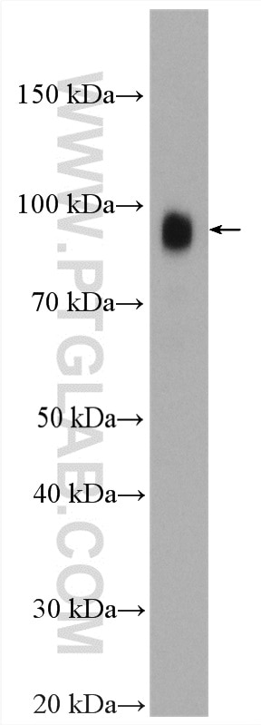 Western Blot (WB) analysis of mouse spinal cord tissue using TrkB Polyclonal antibody (13129-1-AP)