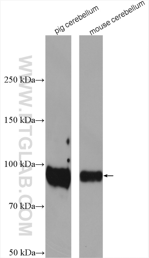 Western Blot (WB) analysis of various lysates using TrkB Polyclonal antibody (13129-1-AP)