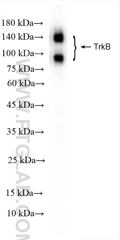 Western Blot (WB) analysis of mouse brain tissue using TrkB Polyclonal antibody (13129-1-AP)