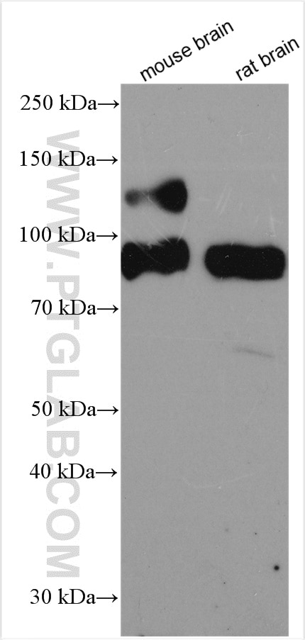 Western Blot (WB) analysis of various lysates using TrkB Polyclonal antibody (13129-1-AP)