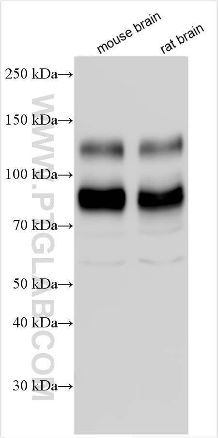 Western Blot (WB) analysis of various lysates using TrkB Polyclonal antibody (13129-1-AP)