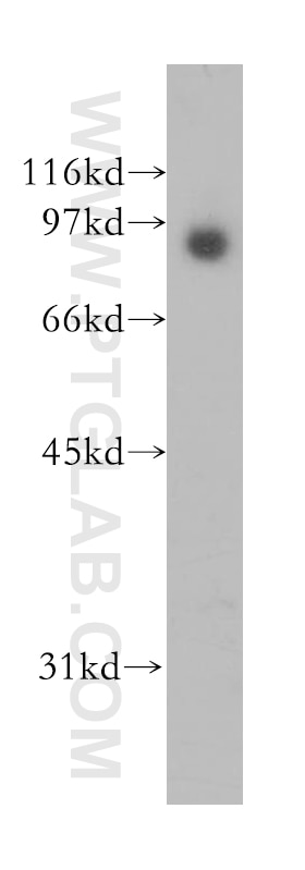 Western Blot (WB) analysis of human cerebellum tissue using TrkB Polyclonal antibody (13129-1-AP)