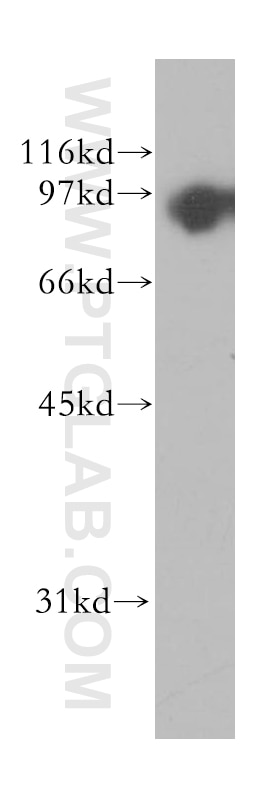 Western Blot (WB) analysis of human stomach tissue using TrkB Polyclonal antibody (13129-1-AP)