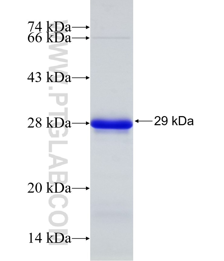 NTRK2 fusion protein Ag32202 SDS-PAGE NTRK2 fusion protein Ag32202 SDS-PAGE