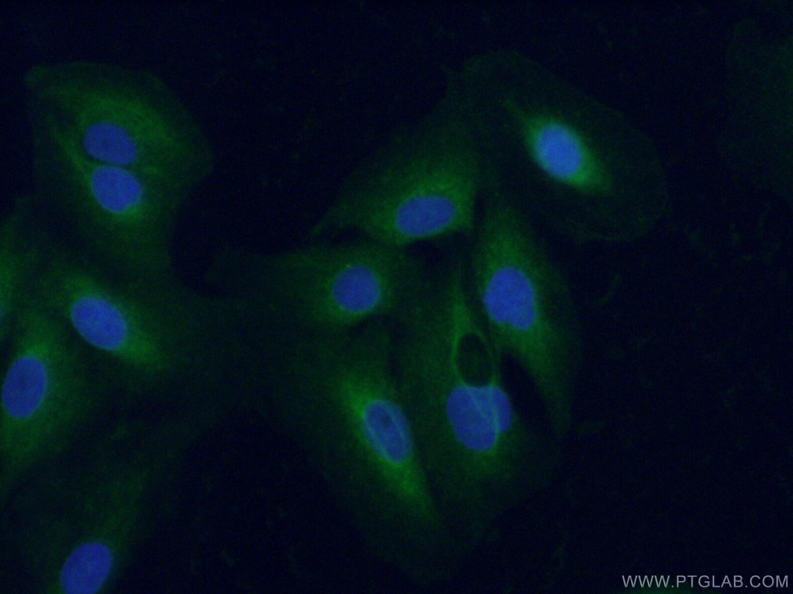 Immunofluorescence (IF) / fluorescent staining of A549 cells using TrkC Polyclonal antibody (11999-1-AP)