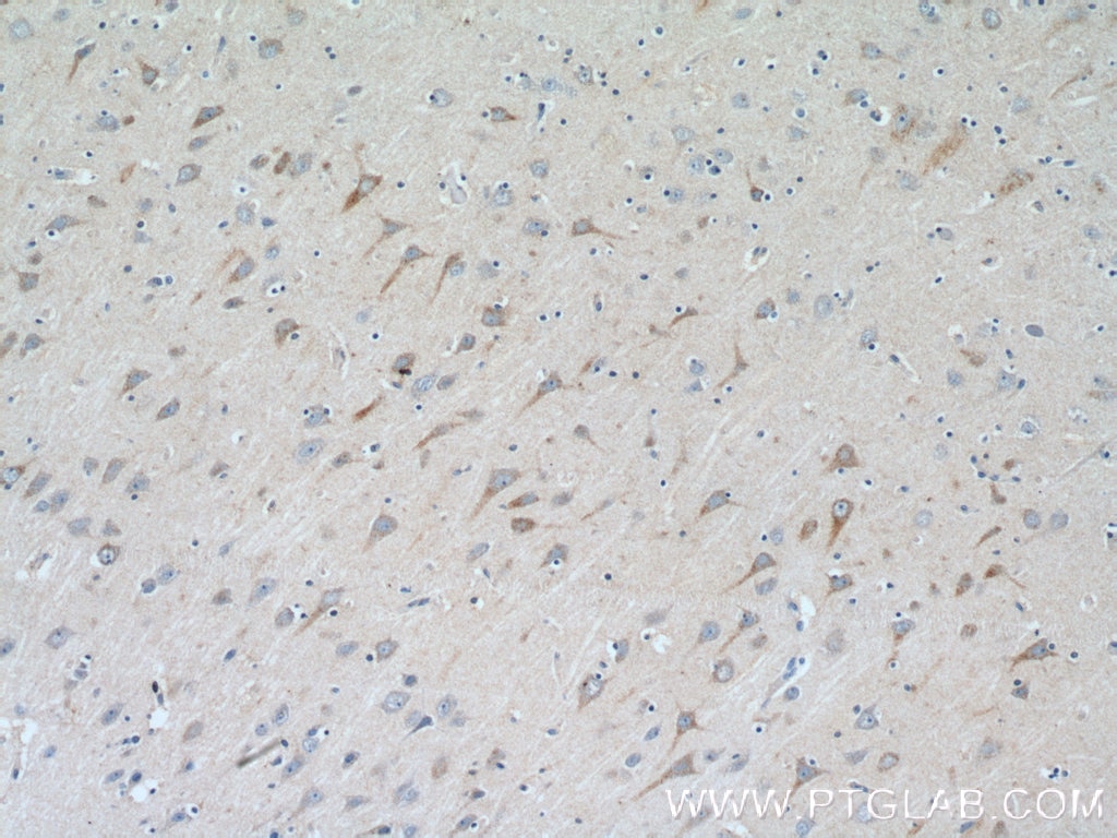 Immunohistochemistry (IHC) staining of human brain tissue using TrkC Polyclonal antibody (11999-1-AP)