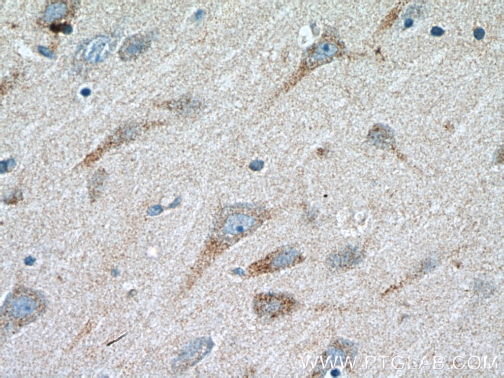 Immunohistochemistry (IHC) staining of human brain tissue using TrkC Polyclonal antibody (11999-1-AP)