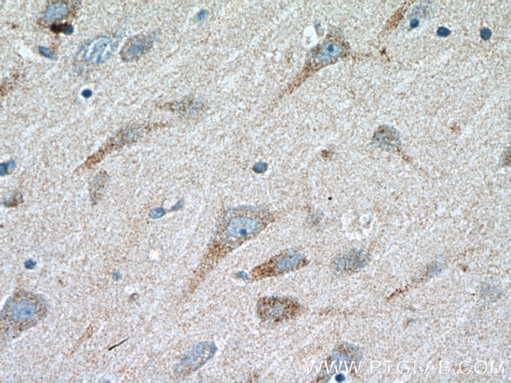 IHC staining of human brain using 11999-1-AP