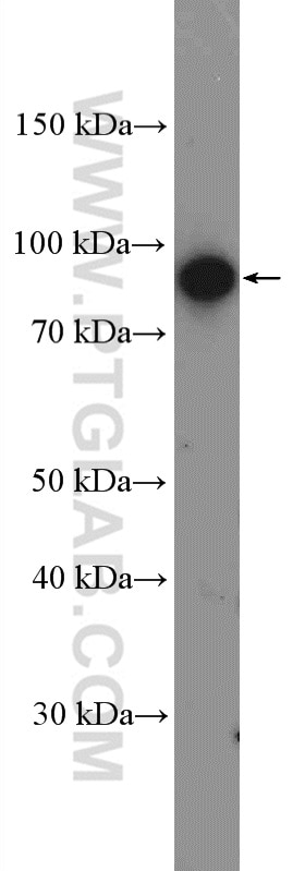 Western Blot (WB) analysis of fetal human brain tissue using TrkC Polyclonal antibody (11999-1-AP)