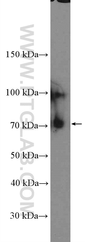 Western Blot (WB) analysis of mouse brain tissue using TrkC Polyclonal antibody (11999-1-AP)