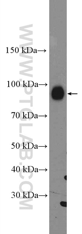 Western Blot (WB) analysis of rat brain tissue using TrkC Polyclonal antibody (11999-1-AP)