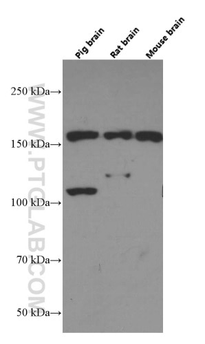 Western Blot (WB) analysis of various lysates using TrkC Monoclonal antibody (66380-1-Ig)