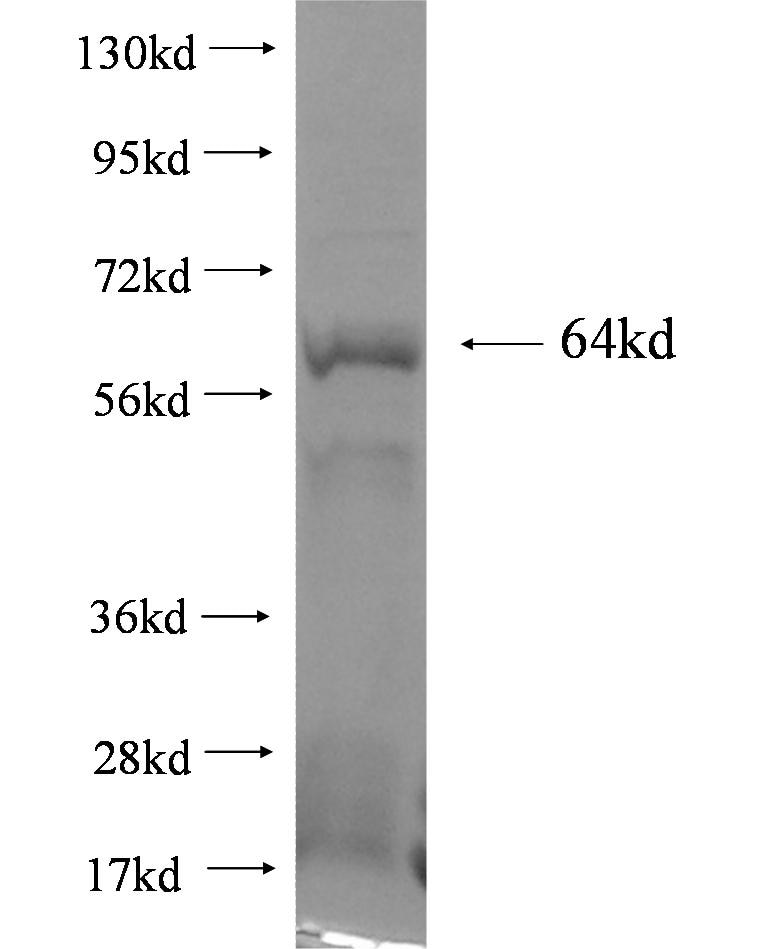 NTRK3 fusion protein Ag2635 SDS-PAGE
