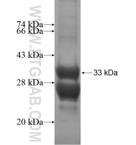 NTSR2 fusion protein Ag14218 SDS-PAGE