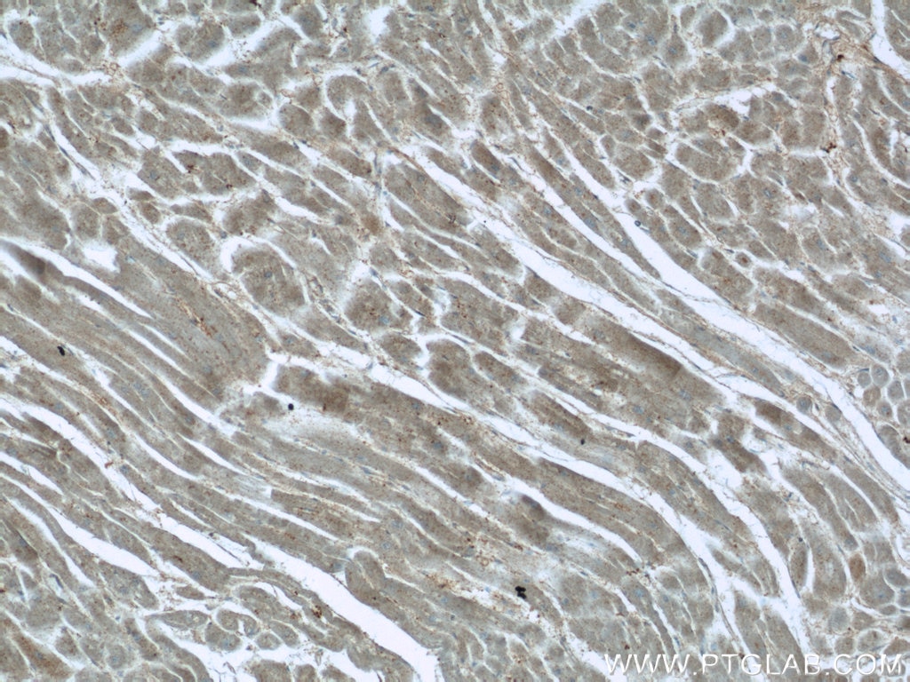 Immunohistochemistry (IHC) staining of human heart tissue using ARK5 Polyclonal antibody (22723-1-AP)