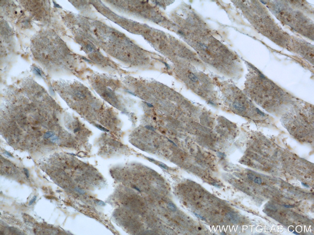 Immunohistochemistry (IHC) staining of human heart tissue using ARK5 Polyclonal antibody (22723-1-AP)