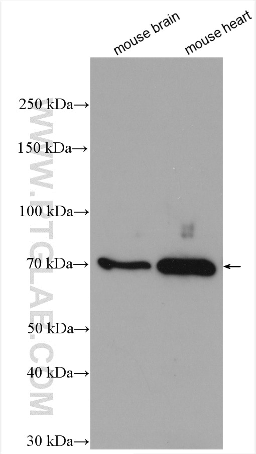 Western Blot (WB) analysis of mouse brain tissue using ARK5 Polyclonal antibody (22723-1-AP)