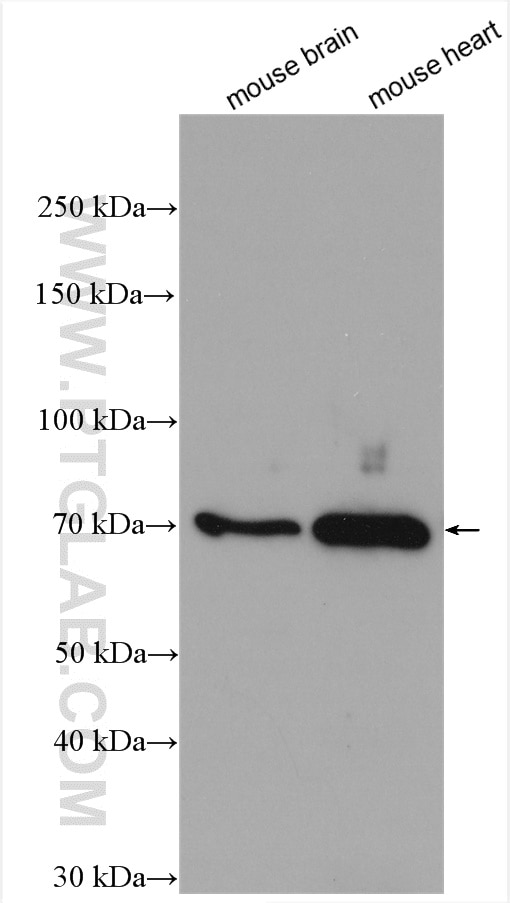 WB analysis of mouse brain using 22723-1-AP