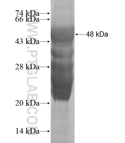 NUAK1 fusion protein Ag18612 SDS-PAGE