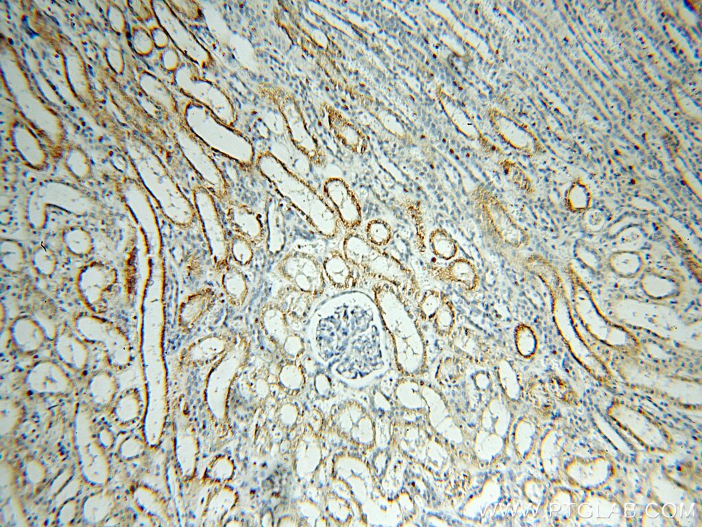 Immunohistochemistry (IHC) staining of human kidney tissue using NUAK2 Polyclonal antibody (11592-1-AP)