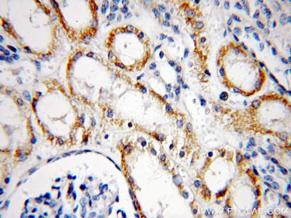 Immunohistochemistry (IHC) staining of human kidney tissue using NUAK2 Polyclonal antibody (11592-1-AP)