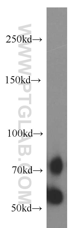 Western Blot (WB) analysis of HeLa cells using NUAK2 Polyclonal antibody (11592-1-AP)