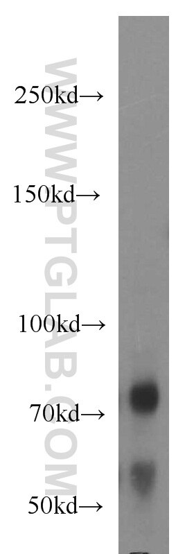 WB analysis of HeLa using 11592-1-AP