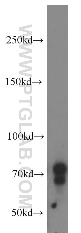 Western Blot (WB) analysis of Y79 cells using NUAK2 Polyclonal antibody (11592-1-AP)