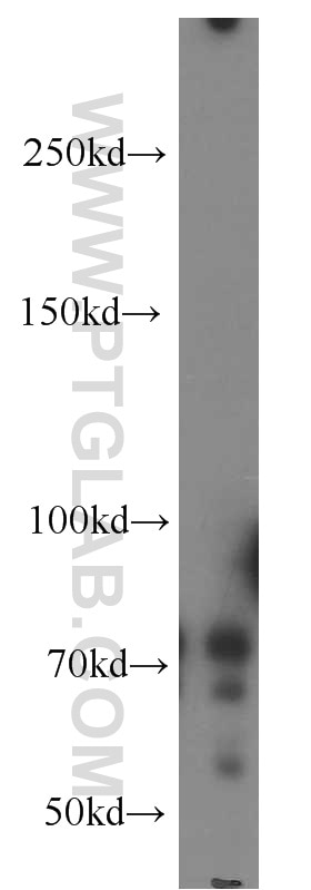 Western Blot (WB) analysis of Y79 cells using NUAK2 Polyclonal antibody (11592-1-AP)