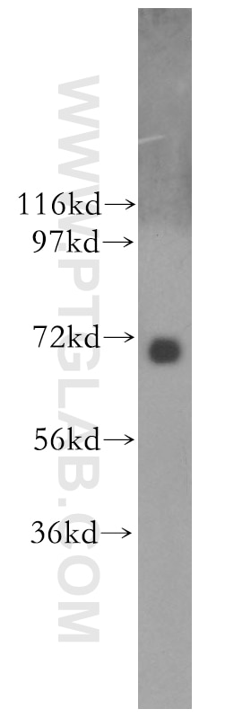 Western Blot (WB) analysis of Y79 cells using NUAK2 Polyclonal antibody (11592-1-AP)