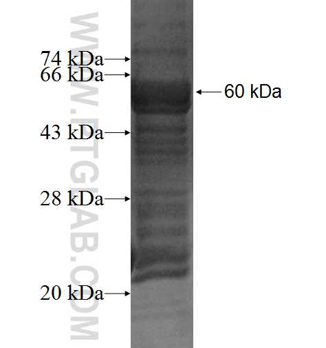 NUAK2 fusion protein Ag2031 SDS-PAGE