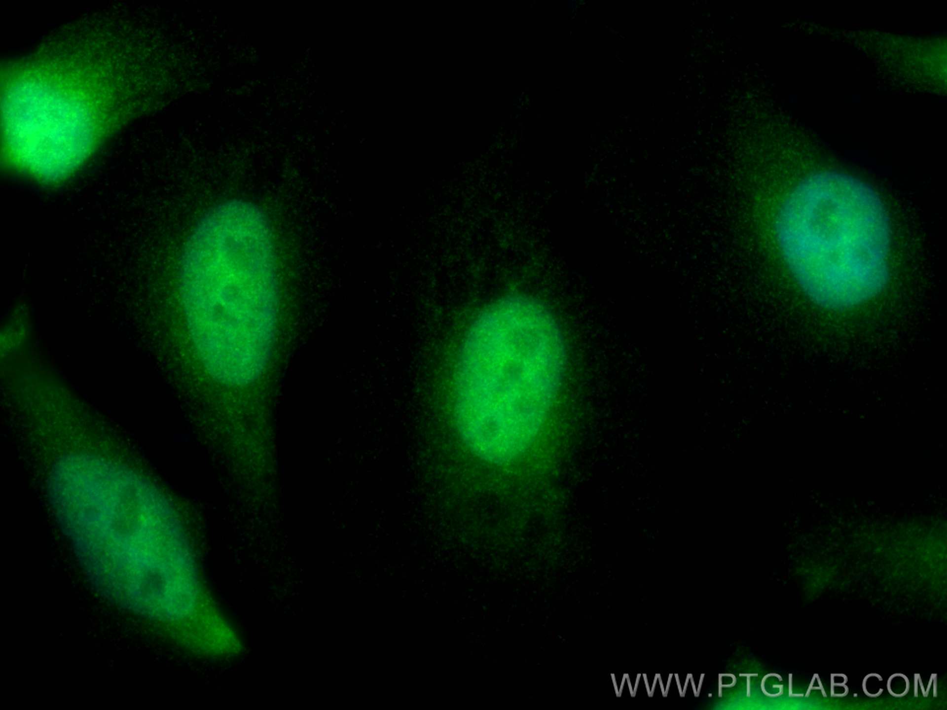 Immunofluorescence (IF) / fluorescent staining of HeLa cells using NUB1 Polyclonal antibody (14343-1-AP)