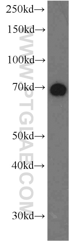 Western Blot (WB) analysis of HeLa cells using NUB1 Polyclonal antibody (14343-1-AP)