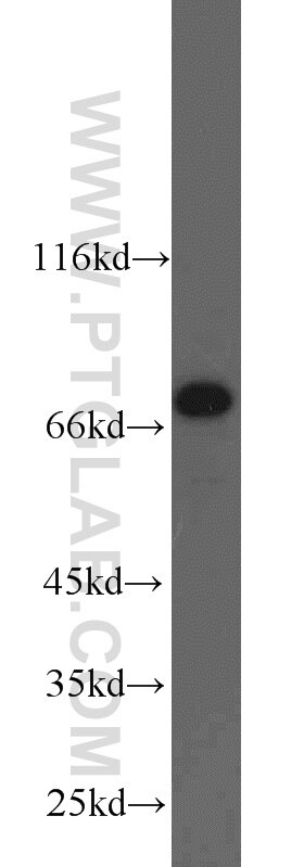 Western Blot (WB) analysis of HepG2 cells using NUB1 Polyclonal antibody (14343-1-AP)