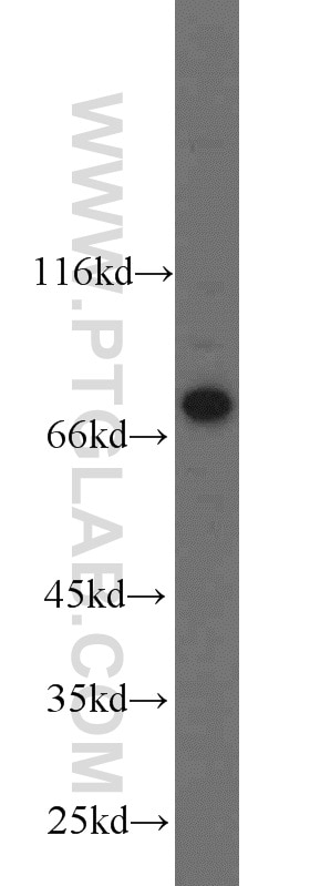 Western Blot (WB) analysis of K-562 cells using NUB1 Polyclonal antibody (14343-1-AP)
